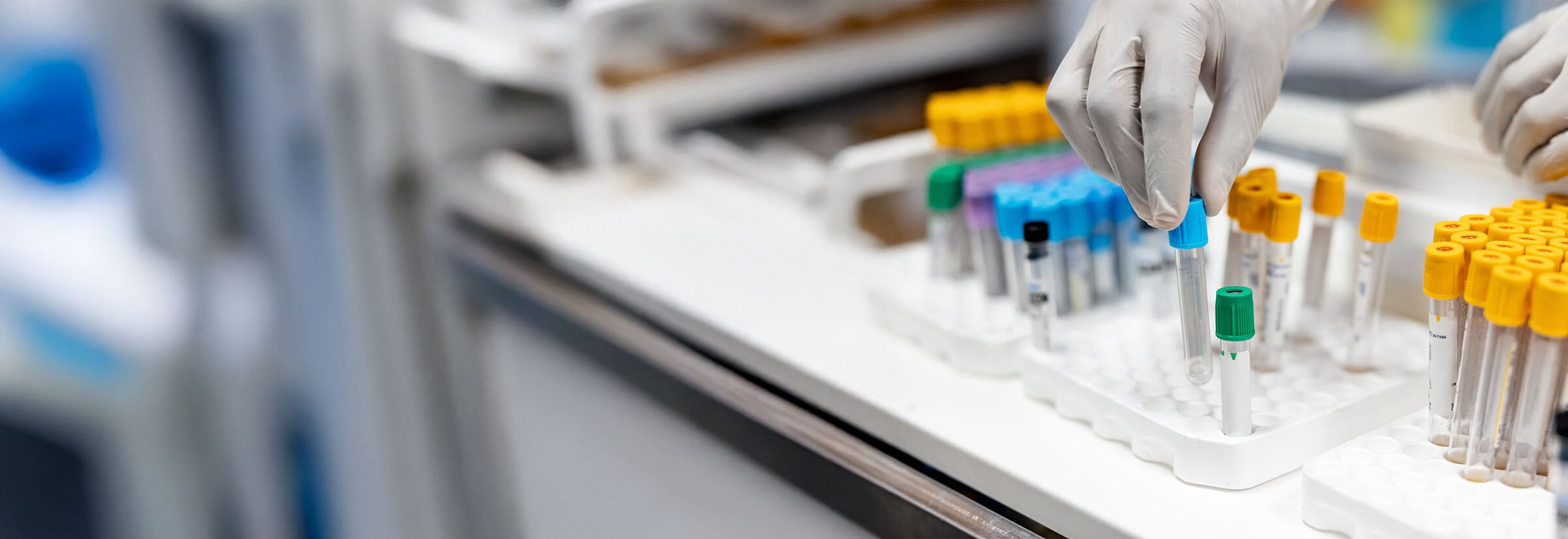 A gloved hand handles genetic test tubes in a laboratory setting.